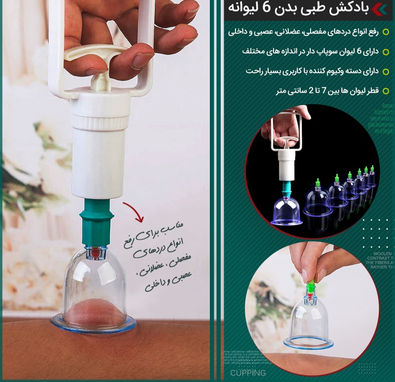 بادکش طبی بدن 6 لیوانه - تصویر 2